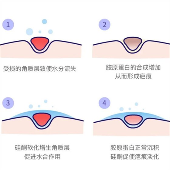 疤痕貼20210625